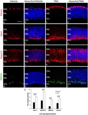 TAK1 inhibition increases proliferation and differentiation of chick retinal cells